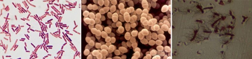 Escherichia Sticks, Fekálny enterokok a pro - hlavné patogény chronickej bakteriálnej prostatitídy